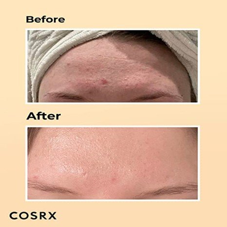 Cosrx Advanced Snail 96 Mucin Power Essence (100ml)