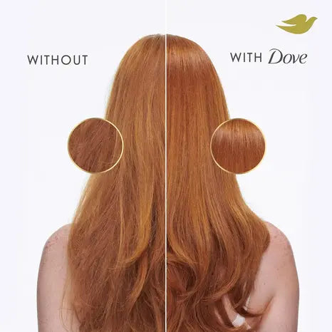 Dove Intensive Repair Conditioner For Damaged Hair 300ml