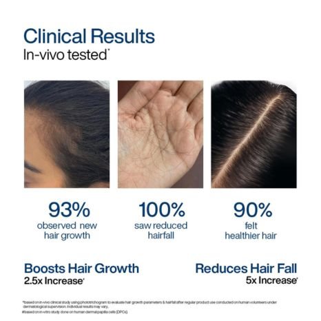 WishCare Hair Growth Serum Concentrate Roll On  10ml