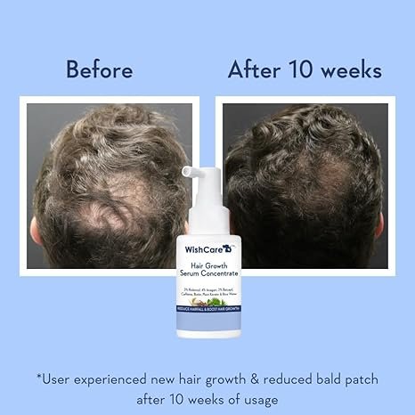 WishCare Hair Growth Serum Concentrate  30ml