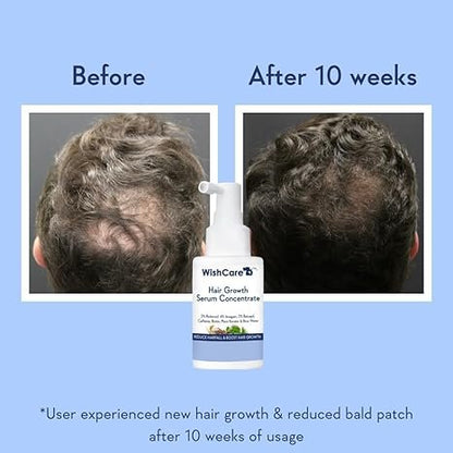 WishCare Hair Growth Serum Concentrate  30ml