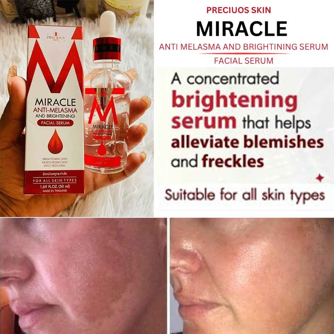 Miracle Anti-Melasma Serum and Brightening-50ml