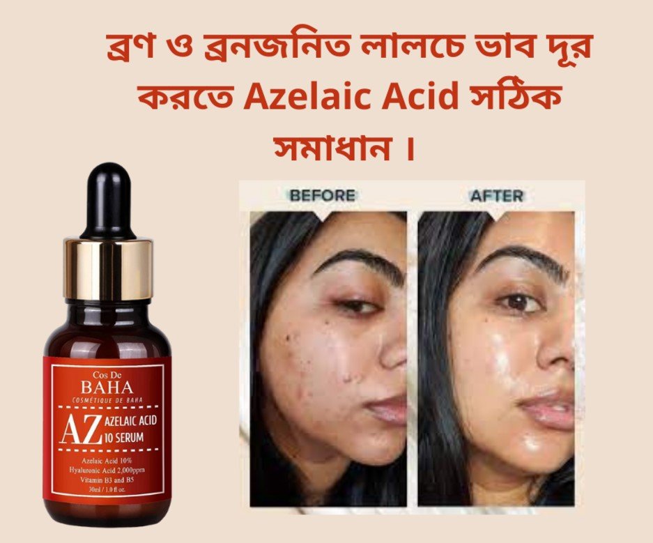 Cos De BAHA Azelaic Acid 10% Serum (30ml)