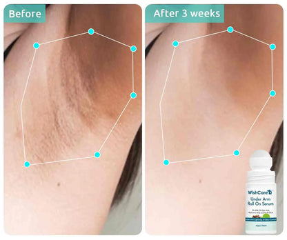 WishCare Under Arm Roll On Serum -50ml