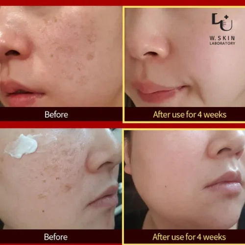 W.Skin Laboratory A M Cream Anti-Melasma 50ml