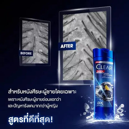 Clear Men Shampoo Anti Dandruff Deep Cleanse    165ml