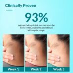 Fixderma Nigrifix Cream with Retinol, Lactic Acic & Urea    50g - Image 2